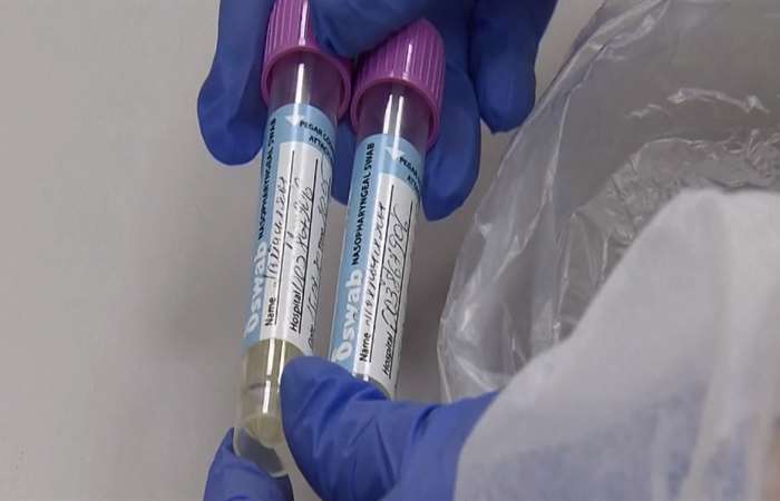 Nhiều nước thử nghiệm lâm sàng vaccine phòng SARS-CoV-2