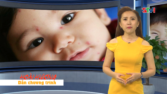365 ngày khỏe - Cách phòng chống bệnh thủy đậu 03-09-2016