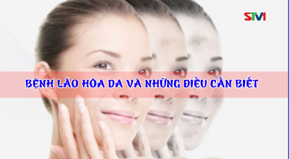 365 ngày khỏe 08-02-2017