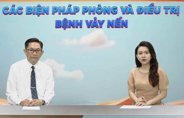 Các biện pháp phòng và điều trị bệnh vảy nến (16-12-2024)