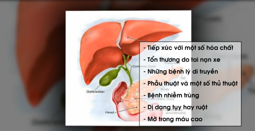 Nhịp cầu y tế- Phòng và điều trị viêm tuỵ cấp 28-06-2016