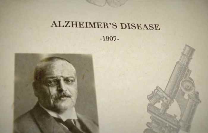 Nhịp cầu sức khỏe - bệnh alzheimer triệu chứng và cách chăm sóc 06-03-2018
