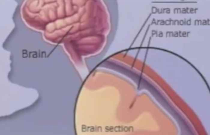 Nhịp cầu sức khỏe Viêm màng não mô cầu 11-12-2018