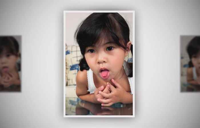 Nhịp cầu sức khỏe Xử lý nhanh hóc dị vật đường thở ở trẻ 13-12-2018