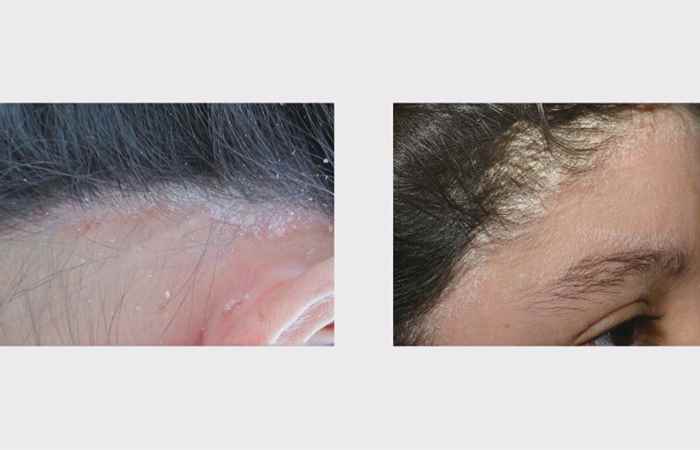Nhịp cầu sức khỏe 21-01-2018