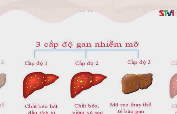 Nhịp cầu sức khỏe 22-12-2018