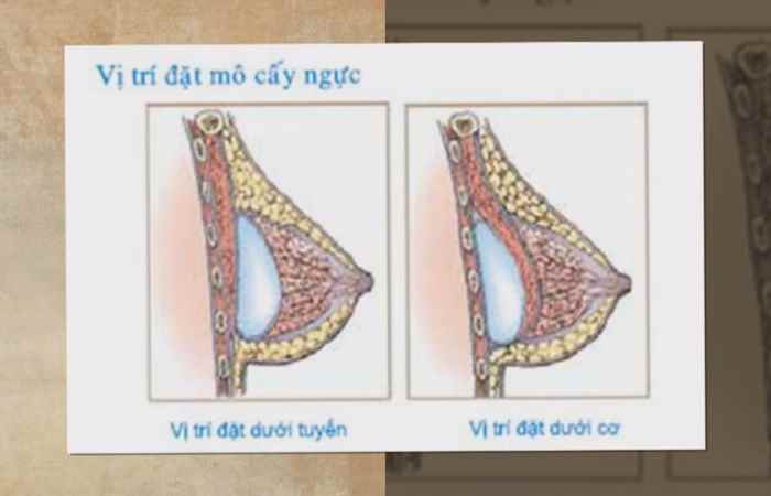 Nhịp cầu y tế - Bắp cải tím tăng cường trí nhớ 26-07-2017