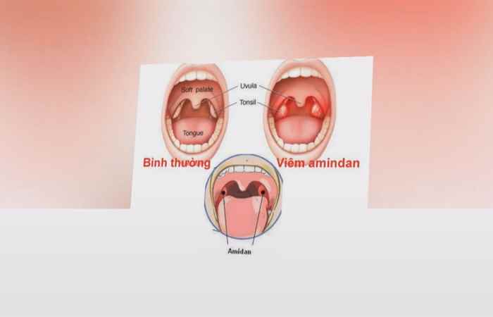 Nhịp cầu y tế - Cây cẩm xà lặc chữa bệnh lỵ 20-10-2017