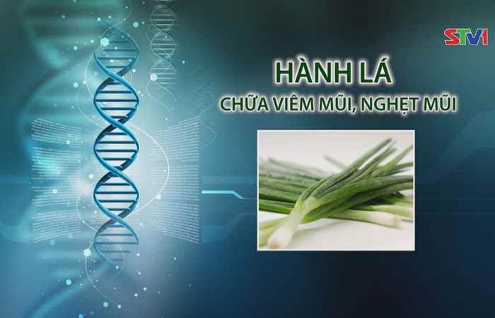 Nhịp cầu y tế - Hành lá chữa viêm mũi nghẹt mũi 16-04-2017