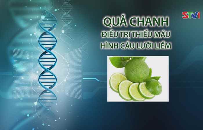 Nhịp cầu y tế - Qủa chanh điều trị thiếu máu hình cầu lưỡi liềm  06-08-2017