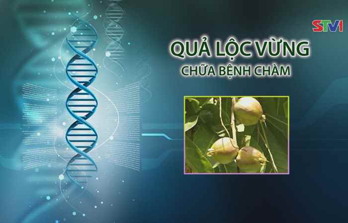 Nhịp cầu y tế - Quả Lộc Vừng 23-04-2017