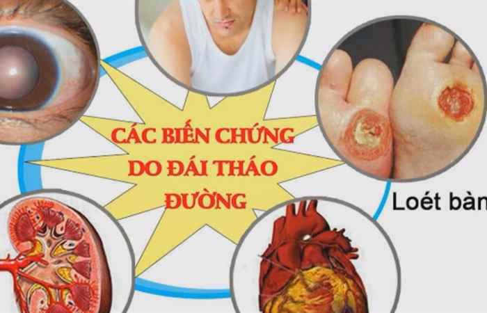 Nhịp cầu y tế - Rau sam điều trị mụn nhọt 03-10-2017