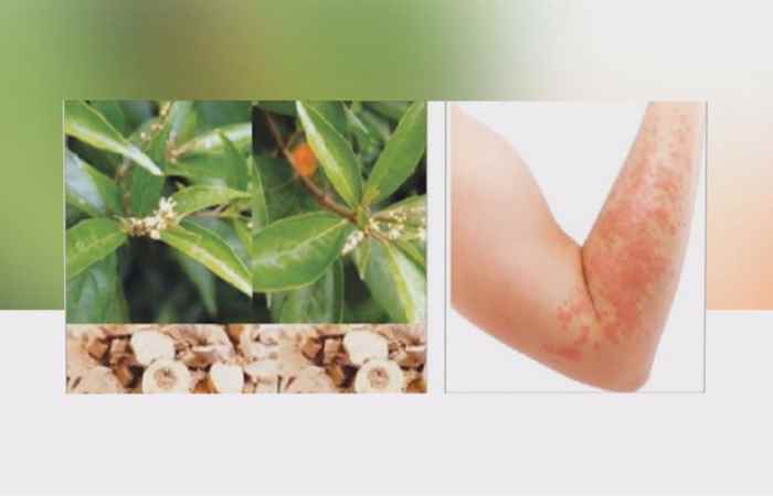 Sống khỏe 360 - Khổ sâm vị thuốc dành cho tiêu hóa (10-03-2020)