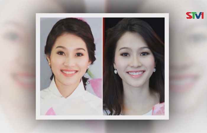 Sống khỏe 360 18-01-2019