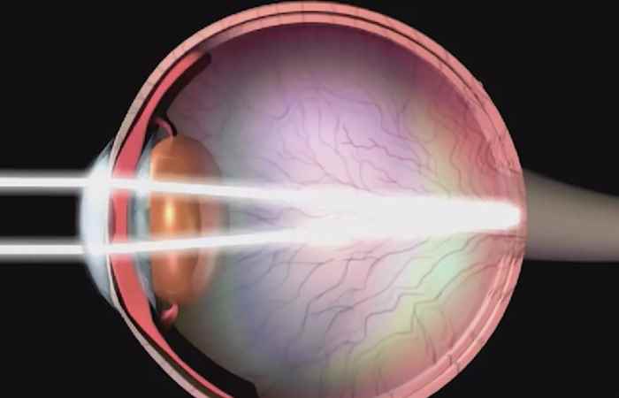 Sống khỏe 360 Ung thư võng mạc nguy cơ mù mắt 18-06-2019