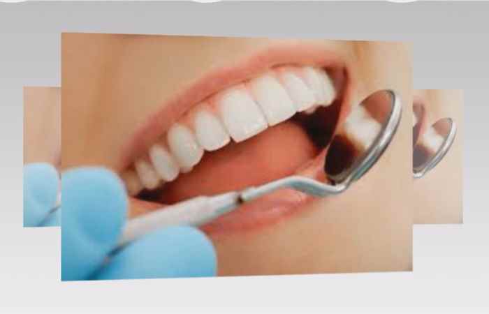 Sống khỏe 360 - Làm thế nào để răng bị lung lay được chắc lại (23-10-2019)