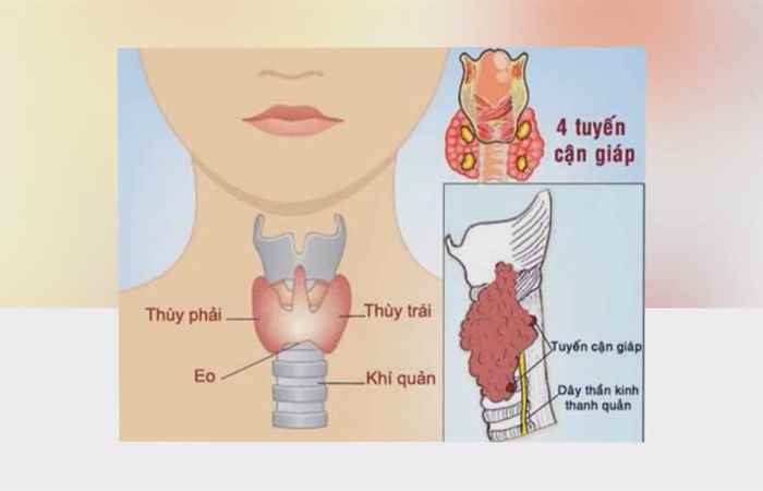 Sống khỏe 360 - Bệnh suy giáp có chữa khỏi được không 02-02-2020