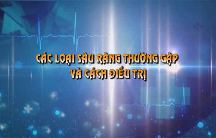 Sống khỏe 360 - Các loại sâu răng thường gặp 01-12-2019