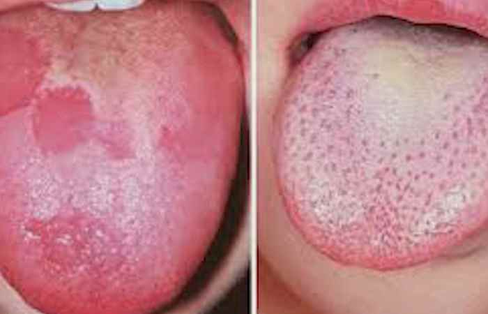 Sống khỏe 360 - Cấy ghép răng Implant là gì ? 27-05-2019