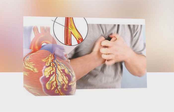 Sống khỏe 360 - Làm sao để phát hiện bệnh động mạch vành 20-02-2020