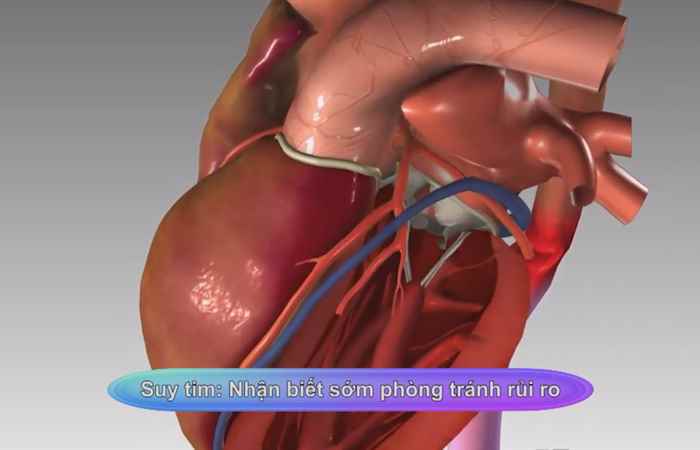 Sống khỏe 360 - Suy tim - Nhận biết sớm phòng tránh rủi ro 26-02-2020
