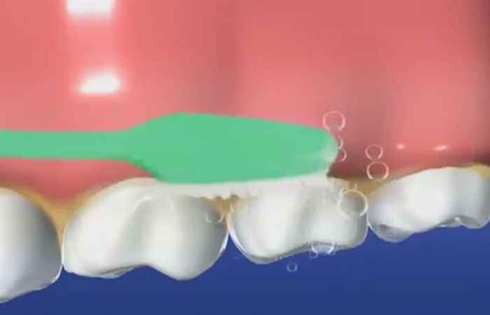 Sống khỏe 360 Viêm nha chu coi chừng rụng răng 01-07-2019