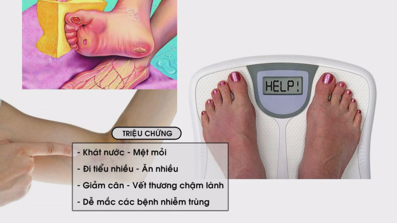 Nhịp cầu y tế 20-07-2016