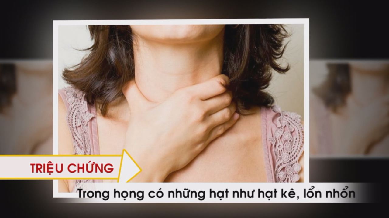 Nhịp cầu y tế - Dự phòng và điều trị lao họng 06-09-2016