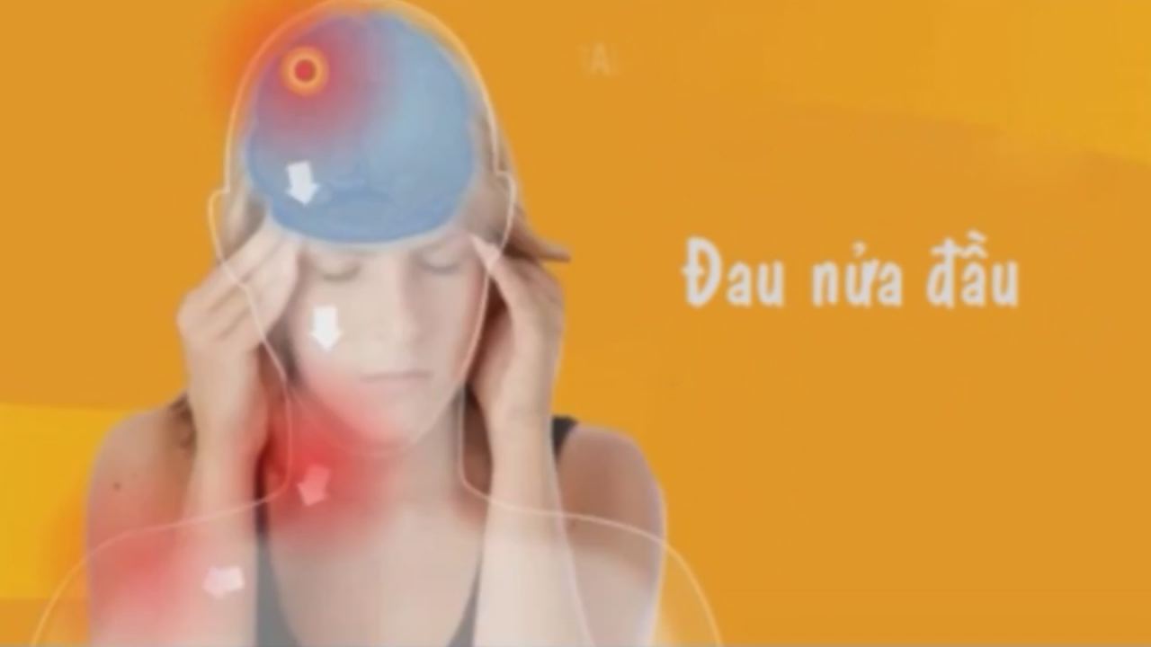 Nhịp cầu y tế - Điều trị Hội chứng đau nửa đầu 20-09-2016