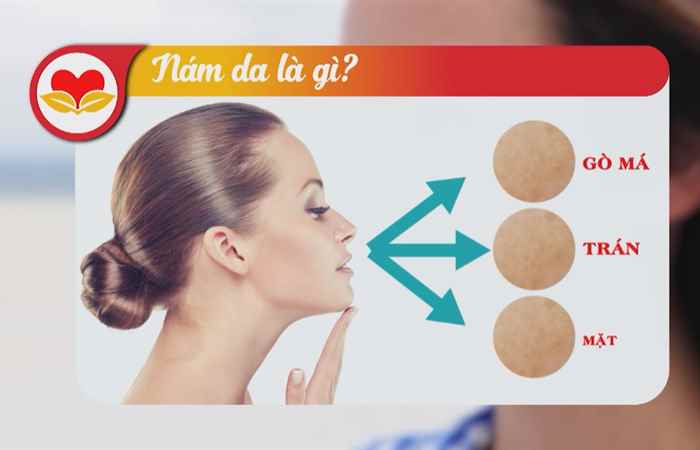 Sức khỏe là vàng - Trầm cảm sau sinh 04-10-2017